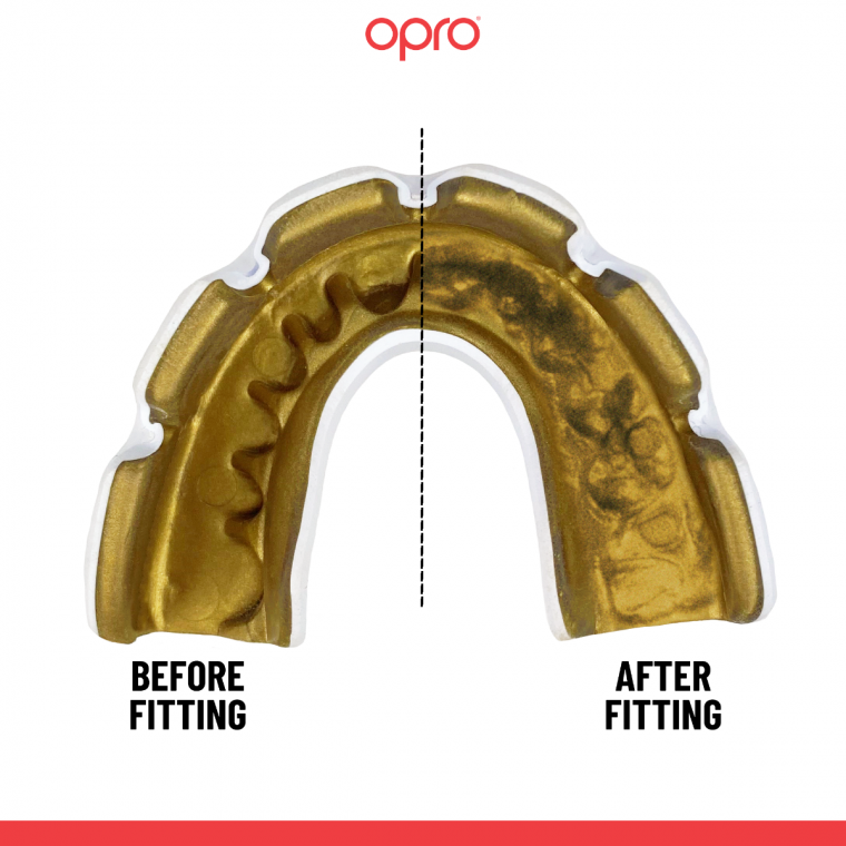 Opro Adults Instant Custom Fit Mouth Guard For Braces - White