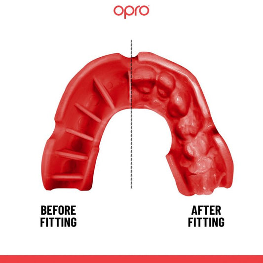 Opro UFC Adults Silver Self Fit Mouth Guard - Black